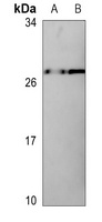 Claudin 7 (Phospho-Y210) Rabbit Polyclonal Antibody