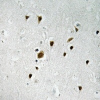 FOXO4 (Phospho-S262) Rabbit Polyclonal Antibody