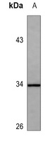 CDK2 (Phospho-T160) Rabbit Polyclonal Antibody