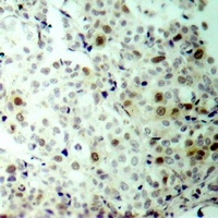 CDK2 (Phospho-T160) Rabbit Polyclonal Antibody