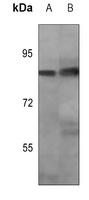 OCT1 (Phospho-S385) Rabbit Polyclonal Antibody
