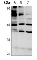ROMK1 (Phospho-S44) Rabbit Polyclonal Antibody