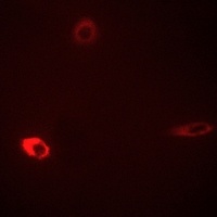 ROMK1 (Phospho-S44) Rabbit Polyclonal Antibody