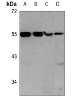 Kir5.1 (Phospho-S416) Rabbit Polyclonal Antibody