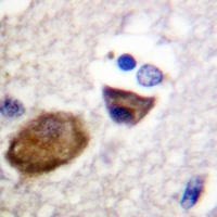 Kir5.1 (Phospho-S416) Rabbit Polyclonal Antibody