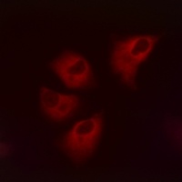 Kir5.1 (Phospho-S416) Rabbit Polyclonal Antibody