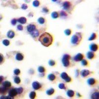 CD129 (Phospho-S519) Antibody