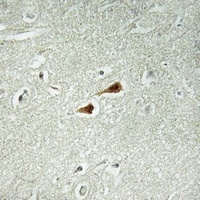 JIP1 (Phospho-T103) Rabbit Polyclonal Antibody