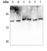 ATRIP (Phospho-S68) Rabbit Polyclonal Antibody