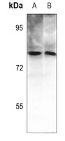 PKC theta (Phospho-T538) Rabbit Polyclonal Antibody