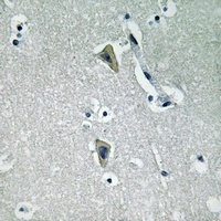 PKC theta (Phospho-T538) Rabbit Polyclonal Antibody