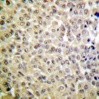 MSK1 (Phospho-S360) Rabbit Polyclonal Antibody