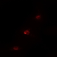 MSK1 (Phospho-S360) Rabbit Polyclonal Antibody