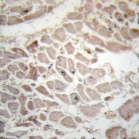 CD247 (Phospho-Y142) Antibody