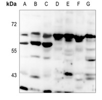 MCOLN3 Rabbit Polyclonal Antibody