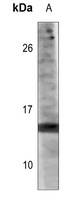 Histone H3 (Acetyl-K14) Antibody