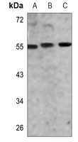 CD181 Rabbit Polyclonal Antibody