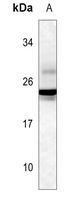 GH1/2 Antibody