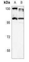 SERCA2 Rabbit Polyclonal Antibody