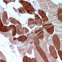 SERCA2 Rabbit Polyclonal Antibody