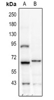 IFNAR1 Antibody