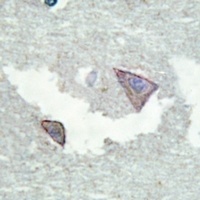 PDGFR alpha (Phospho-Y754) Antibody