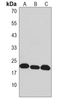 NDUFB8 Rabbit Polyclonal Antibody