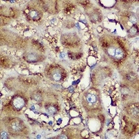 NDUFB8 Rabbit Polyclonal Antibody