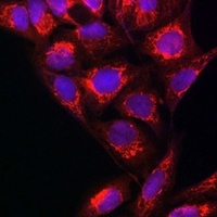 NDUFB8 Rabbit Polyclonal Antibody