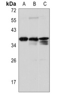 TMX2 Rabbit Polyclonal Antibody
