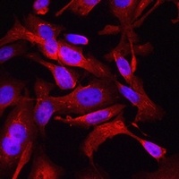 STAT6 Antibody