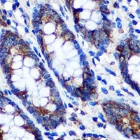 STAT4 Rabbit Polyclonal Antibody