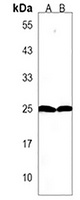 lin28a Rabbit Polyclonal Antibody