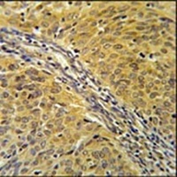 DYNC1LI2 Rabbit Polyclonal Antibody