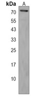 CCZ1 Rabbit Polyclonal Antibody