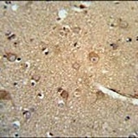 CCZ1 Rabbit Polyclonal Antibody
