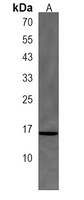CRABP1 Rabbit Polyclonal Antibody