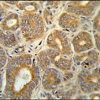 CRABP1 Rabbit Polyclonal Antibody
