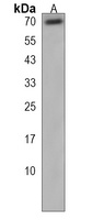 TBKBP1 Rabbit Polyclonal Antibody