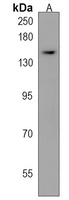 FAN1 Rabbit Polyclonal Antibody