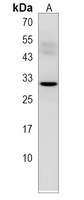 KCTD1 Rabbit Polyclonal Antibody