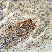 MFAP4 Rabbit Polyclonal Antibody
