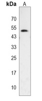 GSDMA Rabbit Polyclonal Antibody