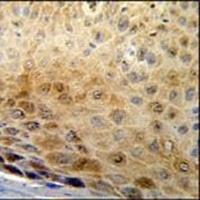 GSDMA Rabbit Polyclonal Antibody