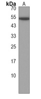 CORO6 Rabbit Polyclonal Antibody