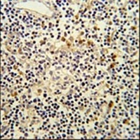 CORO6 Rabbit Polyclonal Antibody
