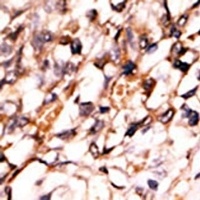 PRAK (Phospho-S93) Rabbit Polyclonal Antibody