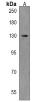 ABL2 Rabbit Polyclonal Antibody