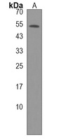 TRAIP Rabbit Polyclonal Antibody