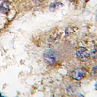 TRAIP Rabbit Polyclonal Antibody